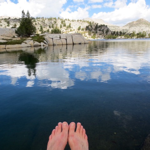 Swelling down my feet.