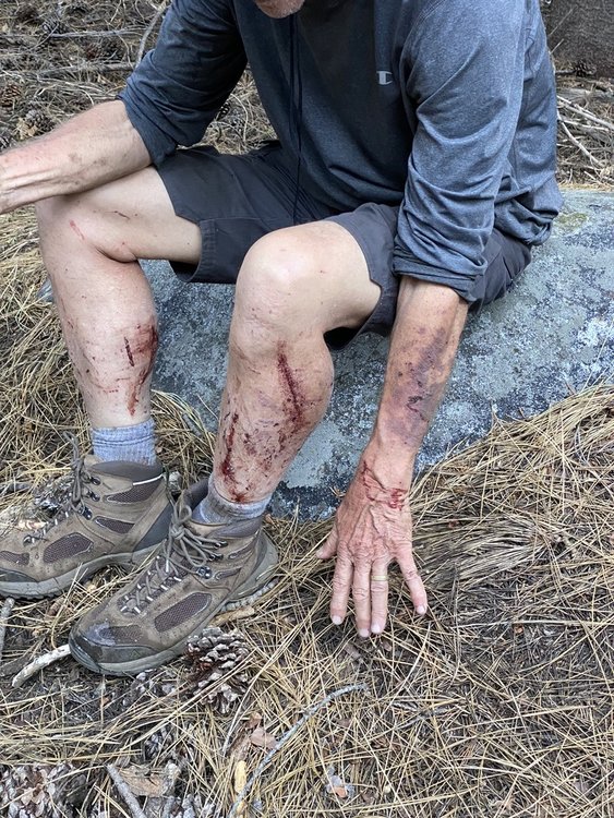 Muro Blanco battle scars