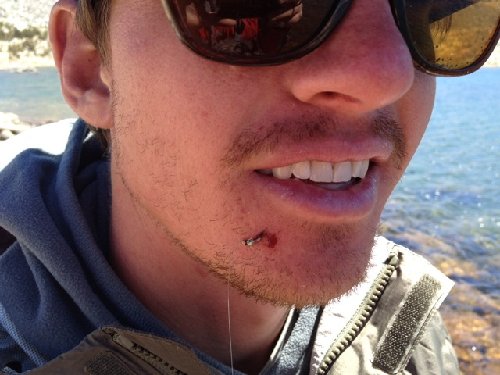 you guys remember this dude, who stuck his finger last time, now he got it in the face!  thats what she said!
