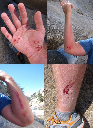 Just a few scrapes